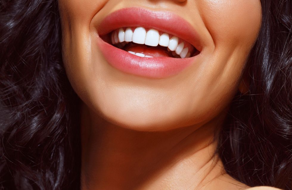 Dental Bonding in Turkey