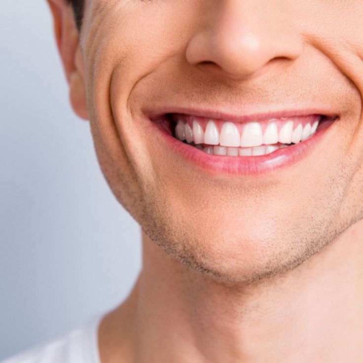 Full Mouth Implants in Turkey