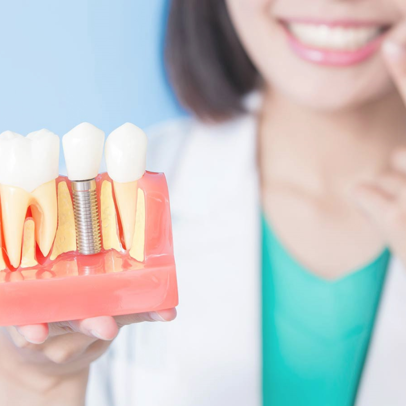 Implant Treatment