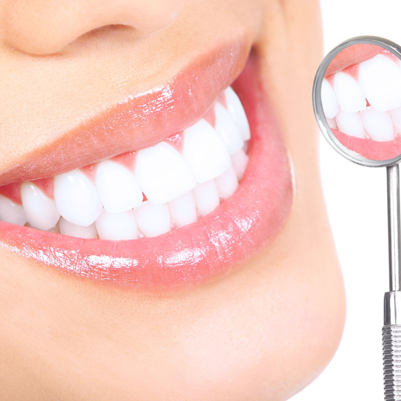 Tooth Whitening